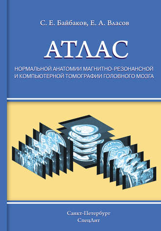 С. Е. Байбаков. Атлас нормальной анатомии магнитно-резонансной и компьютерной томографии головного мозга