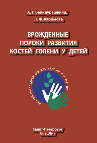 . Врожденные пороки развития костей голени у детей