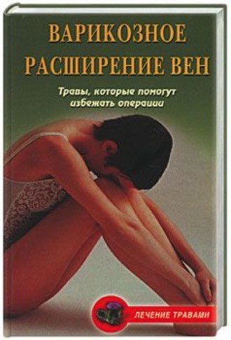 . Варикозное расширение вен. Травы, которые помогут избежать операции