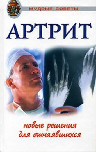 . Артриты. Травы, которые помогут избежать операции
