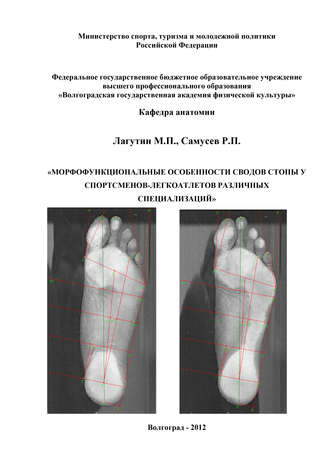. Морфофункциональные особенности сводов стопы у спортсменов-легкоатлетов различных специализаций