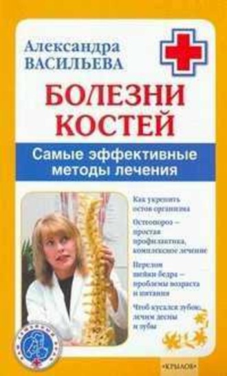 . Болезни костей. Самые эффективные методы лечения