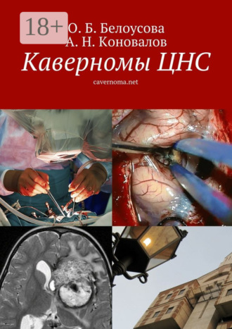 О. Б. Белоусова. Каверномы ЦНС. cavernoma.net