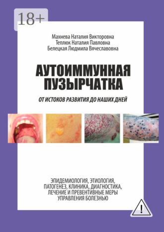. Аутоиммунная пузырчатка. От истоков развития до наших дней
