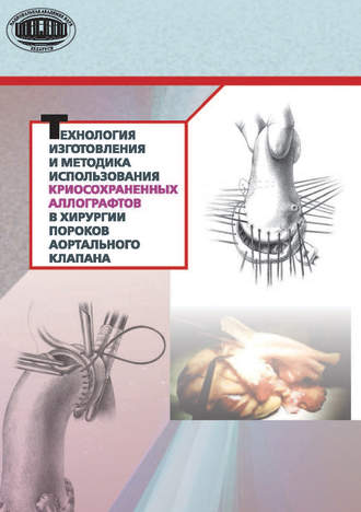 . Технология изготовления и методика использования криосохраненных аллографтов в хирургии пороков аортального клапана
