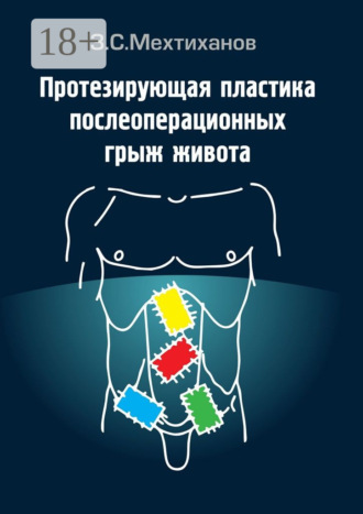 Зубаир Селимович Мехтиханов. Протезирующая пластика послеоперационных грыж живота