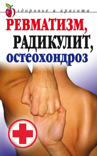. Ревматизм, радикулит, остеохондроз
