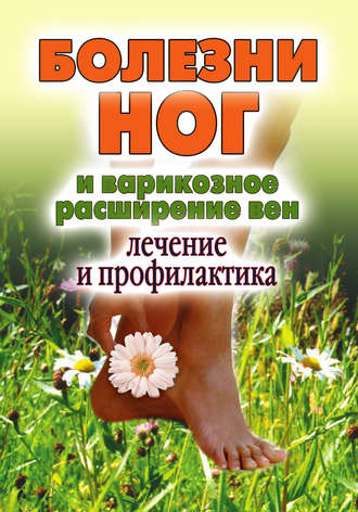 . Болезни ног и варикозное расширение вен. Лечение и профилактика