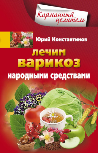 . Лечим варикоз народными средствами