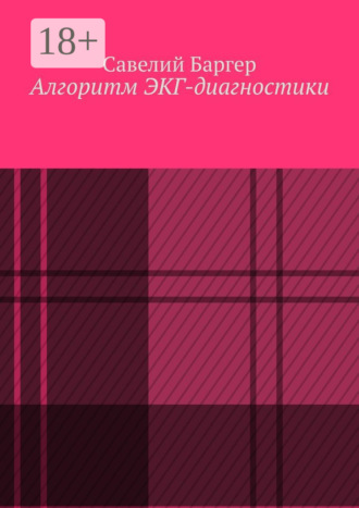 . Алгоритм ЭКГ-диагностики
