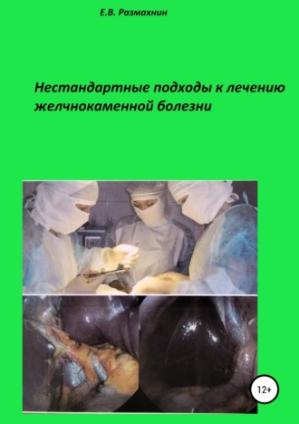 . Нестандартные подходы к лечению желчнокаменной болезни
