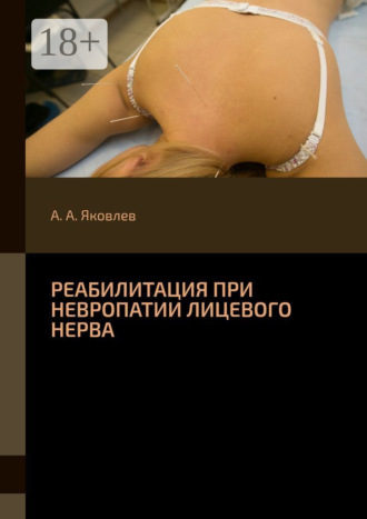 . Реабилитация при невропатии лицевого нерва
