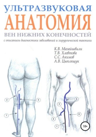 . Ультразвуковая анатомия вен нижних конечностей