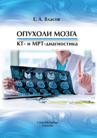 Е. А. Власов. Опухоли мозга. КТ- и МРТ-диагностика