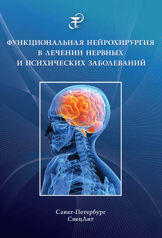 . Функциональная нейрохирургия в лечении нервных и психических заболеваний