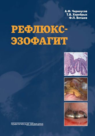 Александр Черноусов. Рефлюкс-эзофагит