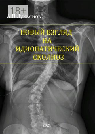 Андрей Петрович Лукьянов. Новый взгляд на идиопатический сколиоз