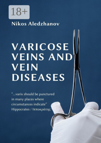 Nikos Aledzhanov. VARICOSE VEINS AND VEIN DISEASES