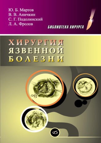 . Хирургия язвенной болезни