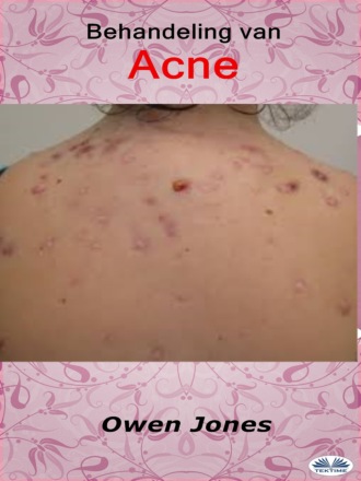 Оуэн Джонс. Behandeling Van Acne
