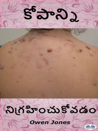 Оуэн Джонс. ముఖ మొటిమల చికిత్స