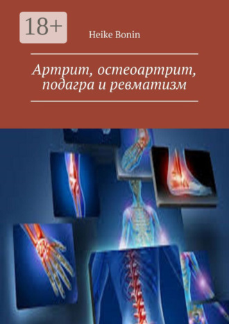 Heike Bonin. Артрит, остеоартрит, подагра и ревматизм