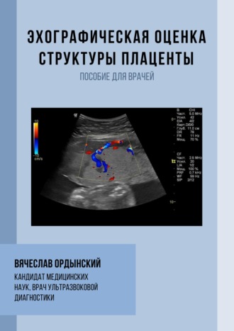 . Эхографическая оценка структуры плаценты