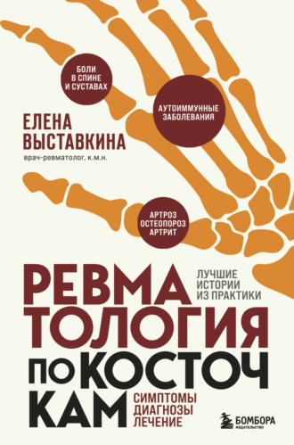 . Ревматология по косточкам. Симптомы, диагнозы, лечение
