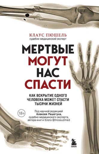 Клаус Пюшель. Мертвые могут нас спасти. Как вскрытие одного человека может спасти тысячи жизней