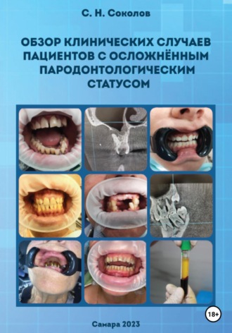 Станислав Николаевич Соколов. Обзор клинических случаев пациентов с осложнённым пародонтологическим статусом