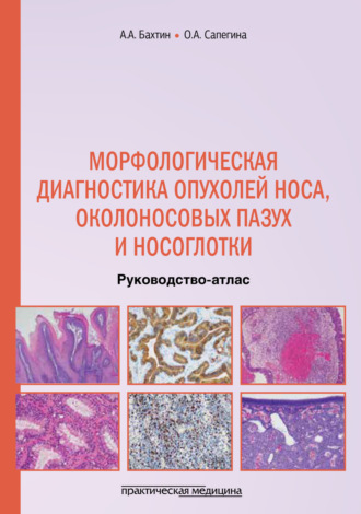 . Морфологическая диагностика опухолей носа, околоносовых пазух и носоглотки