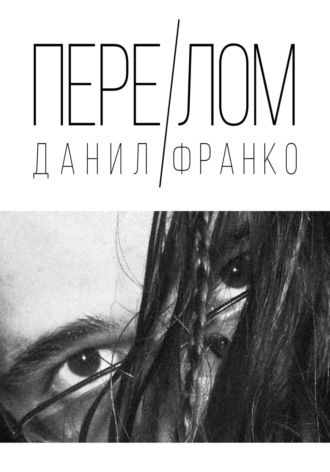 . Перелом