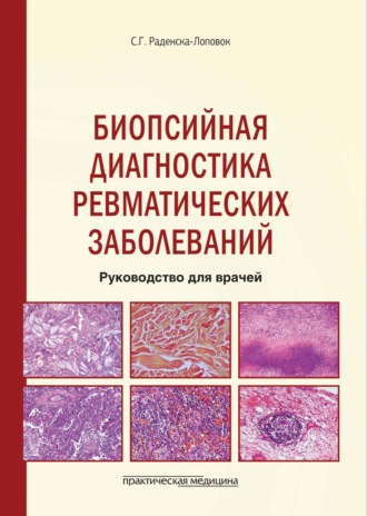 Стефка Раденска-Лоповок. Биопсийная диагностика ревматических заболеваний. Руководство для врачей