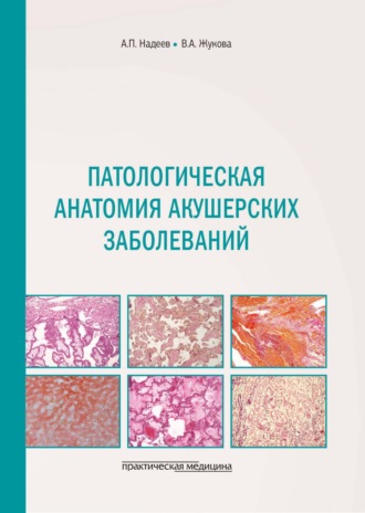 А. П. Надеев. Патологическая анатомия акушерских заболеваний