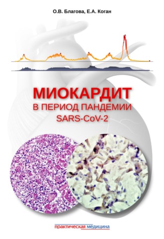 Е. А. Коган. Миокардит в период пандемии SARS-CoV-2