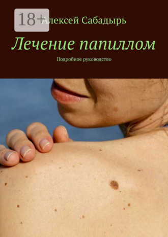 . Лечение папиллом. Подробное руководство