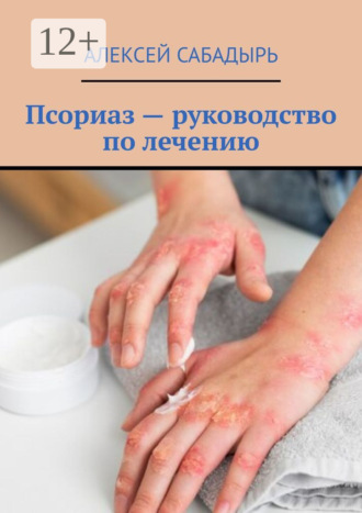 . Псориаз – руководство по лечению