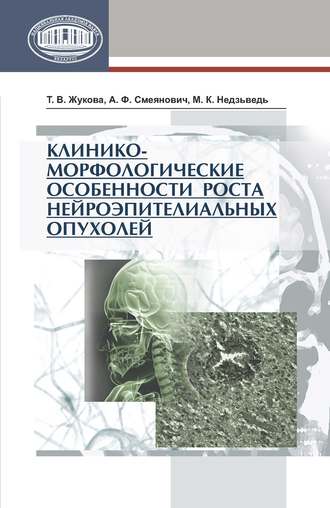 М. К. Недзьведь. Клинико-морфологические особенности роста нейроэпителиальных опухолей