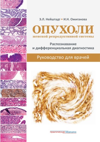 . Опухоли женской репродуктивной системы. Распознавание и дифференциальная диагностика. Руководство для врачей
