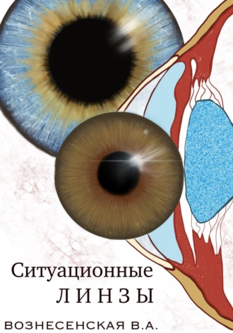 Валерия Алексеевна Вознесенская. Ситуационные линзы