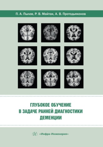 . Глубокое обучение в задаче ранней диагностики деменции
