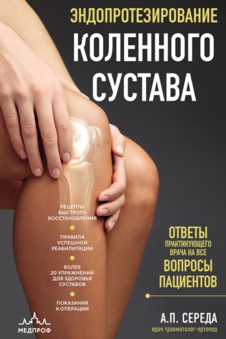 Андрей Середа. Эндопротезирование коленного сустава. Ответы практикующего врача на все вопросы пациентов