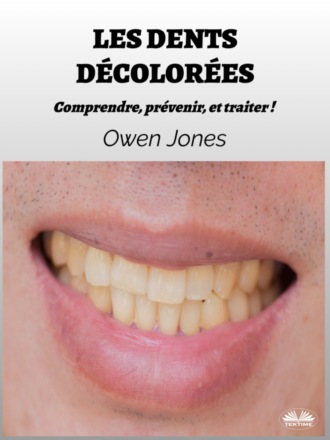 . Les Dents Décolorées