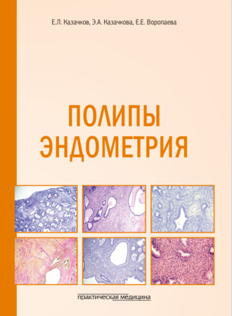 . Полипы эндометрия. Учебное пособие