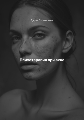 Дарья Владимировна Стрекалина. Психотерапия при акне
