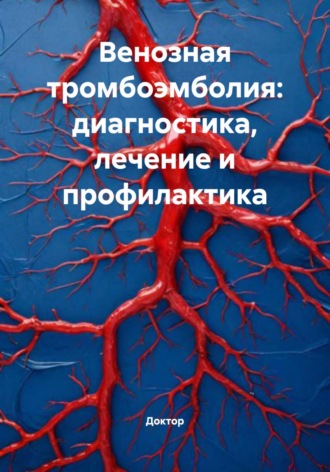 Доктор. Венозная тромбоэмболия: диагностика, лечение и профилактика