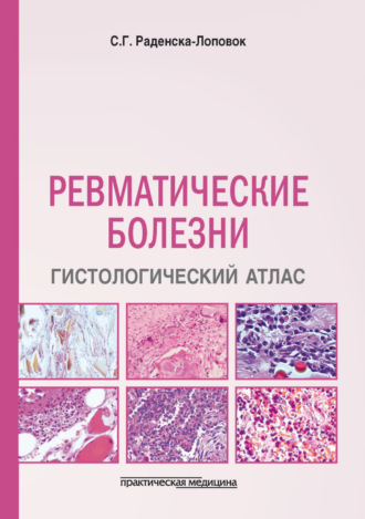 . Ревматические болезни. Гистологический атлас
