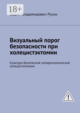 Вадим Владимирович Русин. Визуальный порог безопасности при холецистэктомии. Культура безопасной лапароскопической холецистэктомии