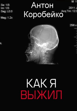 Антон Коробейко. Как я выжил
