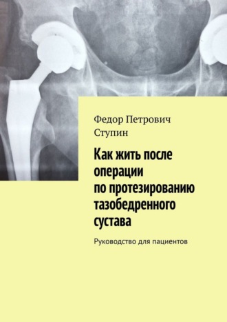 Федор Петрович Ступин. Как жить после операции по протезированию тазобедренного сустава. Руководство для пациентов